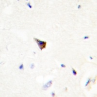 PRKAR1A antibody