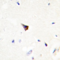 Anti-PRKAR1A Antibody