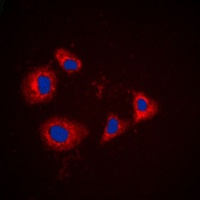 PRKAR1A antibody