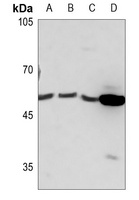 PRKAR1B Rabbit Polyclonal Antibody