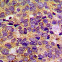 PRKAR2B Antibody