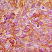 PKC delta (Phospho-T507) Antibody