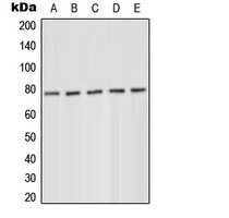PKC delta (Phospho-Y52) Antibody