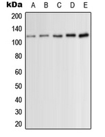 PKC mu (Phospho-S910) Antibody