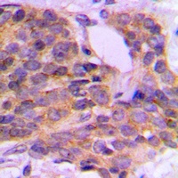 Anti-PKC theta (Phospho-S676) Antibody