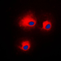 PRKCQ (phospho-S676) antibody