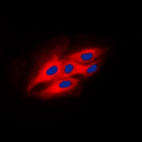 PRKCSH antibody