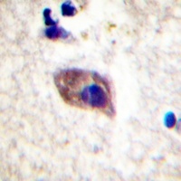Anti-PKC zeta (Phospho-T560) Antibody