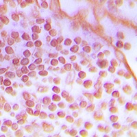 Anti-DNA-PKcs Antibody