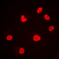 Anti-DNA-PKcs Antibody