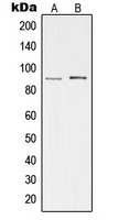 cGK 2 Rabbit Polyclonal Antibody