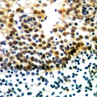 Anti-ERK1/2 Antibody