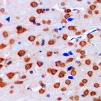 Anti-ERK1/2 Antibody