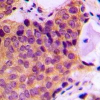 Anti-JNK1/2/3 (Phospho-T183) Antibody