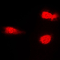Anti-JNK1/2/3 (Phospho-T183) Antibody