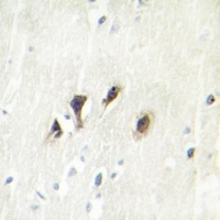 Anti-JNK1/2/3 Antibody