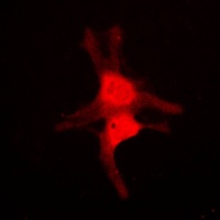 Anti-JNK1/2/3 Antibody