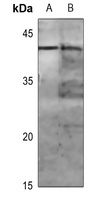 MKK1 (Phospho-T286) Antibody