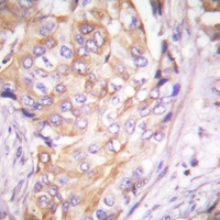 MKK1 (Phospho-T286) Antibody