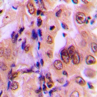 Anti-MKK1 (Phospho-T292) Antibody