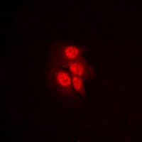 Anti-MKK1 (Phospho-T292) Antibody
