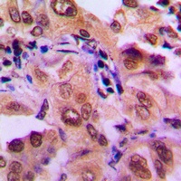 Anti-MKK1 Antibody