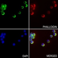 Anti-MKK1 Antibody