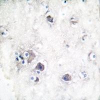 Anti-Peripherin Antibody