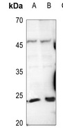 Trypsin 1 Antibody