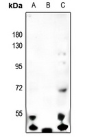 MASP1 HC Antibody