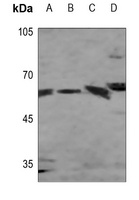 Presenilin 1 Rabbit Polyclonal Antibody