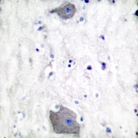 Presenilin 1 Rabbit Polyclonal Antibody