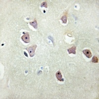 Anti-PSMD2 Antibody