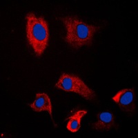 Anti-PSMD2 Antibody