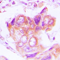 Anti-PSMD2 Antibody