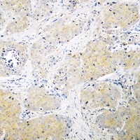 PSMD3 Antibody