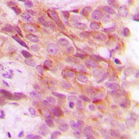 PSMD12 antibody