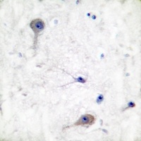 Anti-Patched Antibody