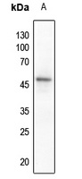 PTEN Rabbit Polyclonal Antibody