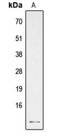 PTH Rabbit Polyclonal Antibody