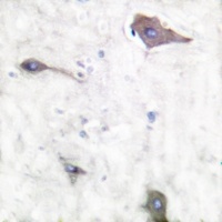 Anti-PGHS-1 Antibody