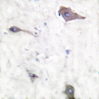 PTGS1 antibody