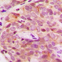 Anti-PGHS-2 Antibody