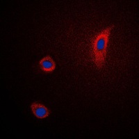 Anti-PGHS-2 Antibody