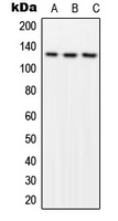 Focal Adhesion Kinase (Phospho-Y576) Antibody
