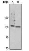 Focal Adhesion Kinase (Phospho-Y861) Antibody