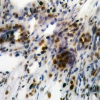 Focal Adhesion Kinase (Phospho-Y861) Antibody