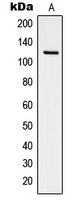 Focal Adhesion Kinase (Phospho-Y925) Antibody