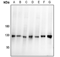 Focal Adhesion Kinase Rabbit Polyclonal Antibody