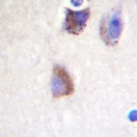 Focal Adhesion Kinase Rabbit Polyclonal Antibody